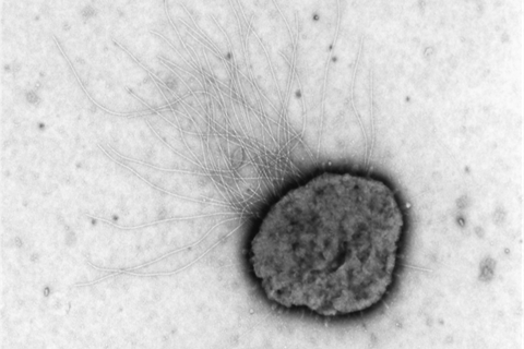 Electron_micrograph_of_Methanococcus_maripaludis