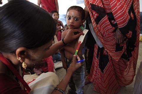 Measuring_for_malnutrition_in_Madhya_Pradesh_(8816985582)