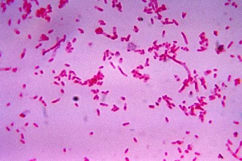 Fusobacterium_novum_01