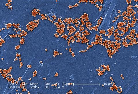 Methicillin-resistant_Staphylococcus_aureus_10048 (1)