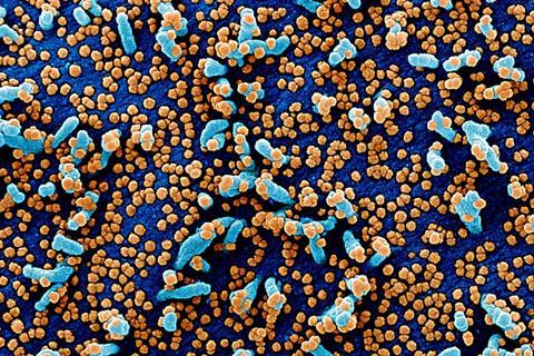 Novel_Coronavirus_SARS-CoV-2_(49680384436)