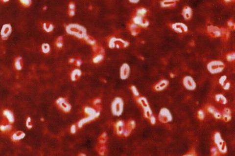 Капсула_Klebsiella_Pneumoniae