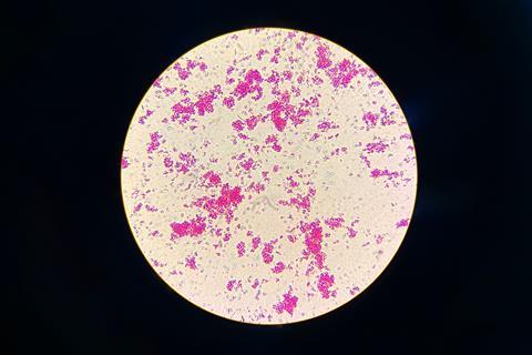 Nontuberculous_Mycobacteria_(NTM)_in_Ziehl-Neelsen_Staining_from_Positive_MGIT_Culture (1)