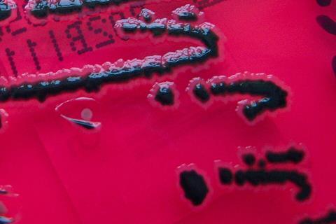 Salmonella_species_growing_on_XLD_agar_-_Showing_H2S_production_-_Detail