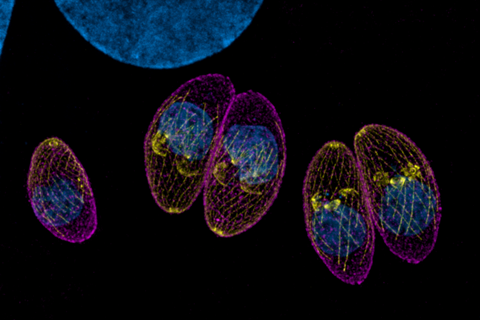 Toxoplasma_parasites_(tachyzoites)_in_a_fibroblast_host_cell (1)