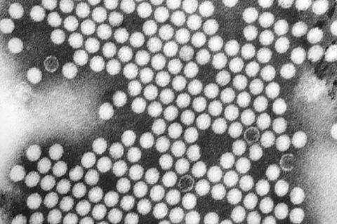 Polio_EM_PHIL_1875_lores