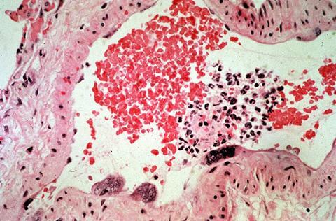 CSIRO_ScienceImage_321_Cross_Section_of_Blood_Vessel_With_Hendra_Virus