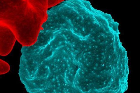 Malaria-infected_Red_Blood_Cell