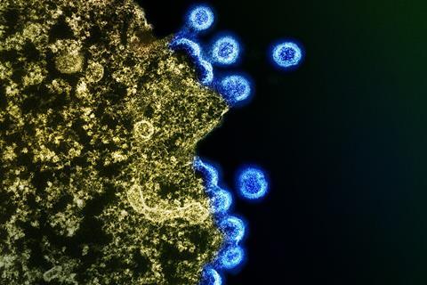 HIV_Virus_Particles_-_53567924670 (1)