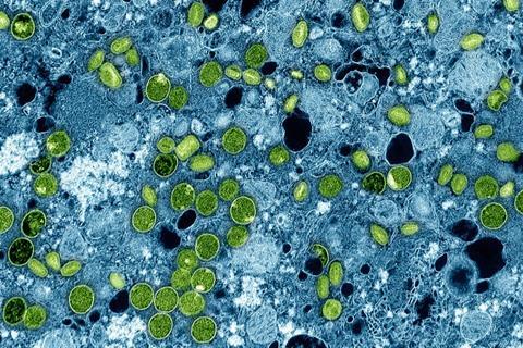 Mpox_Virus_081424