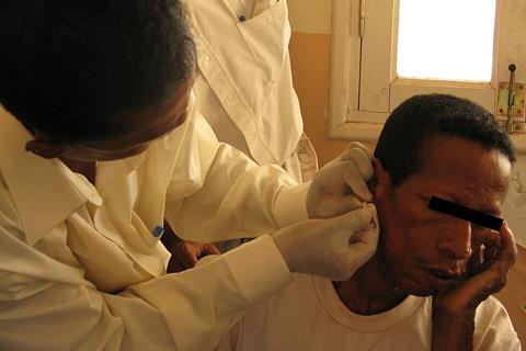 Madagascar_slit_skin_smear_taking_right_earlobe_-_Madagascar_2008