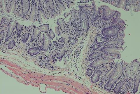 Low-Res_sonnenberg_immunity061125_crop