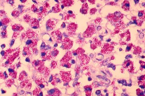 Mycobacterium_avium-intracellulare