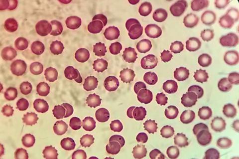 Plasmodium_in_erythrocytic_cycle