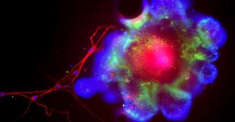 Low-Res_Organoid-teaser-1200x628-UCSDHS