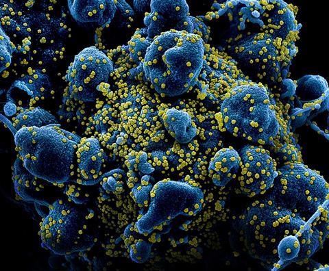 Novel_Coronavirus_SARS-CoV-2_(49680384281)