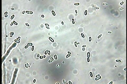 Микроконидии_од_Fusarium_sp