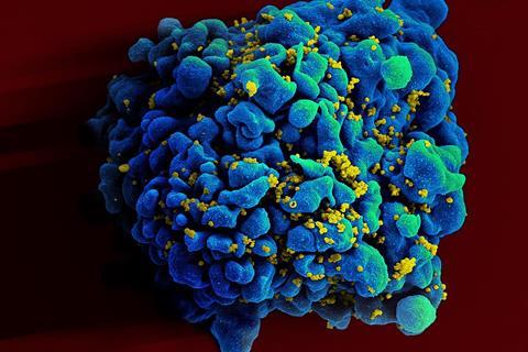 HIV-infected_H9_T_cell_(6813396647)