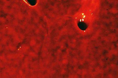 Hepatitis_virica._IMG_2891