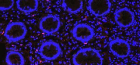 Low-Res_Kim P Feb 24 CMV in Human Intestines