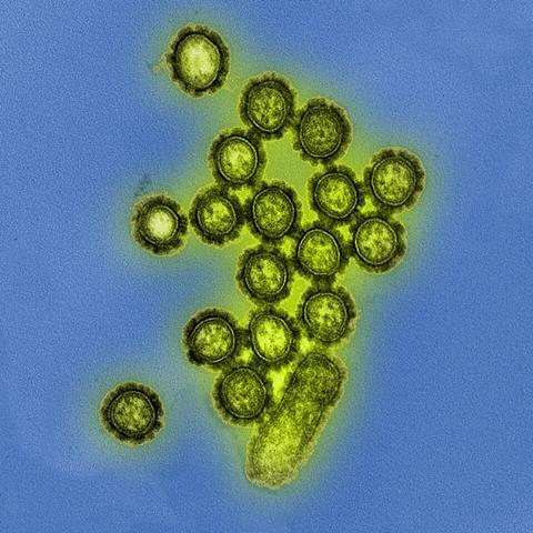H1N1_Influenza_Virus_Particles_(8411599236)