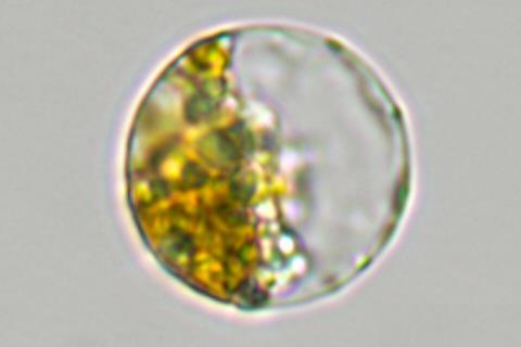 Oogonium_--_3_(34809275943)