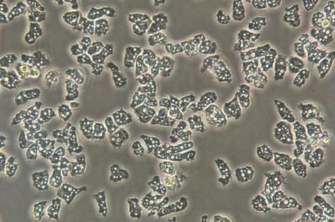 Low-Res_Acanthamoeba