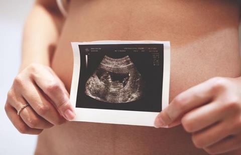 Low-Res_TOMIX_14_4_TOMIX_14_3_Image