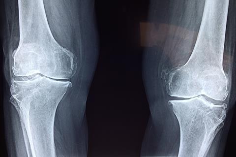 knee-2253047_1280