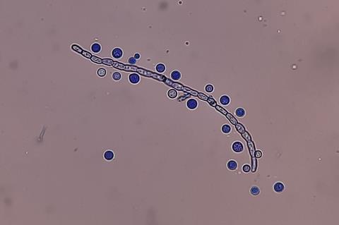 LPCB_Mount_of_Cryptococcus_growth_on_SDA_microscopic_footage