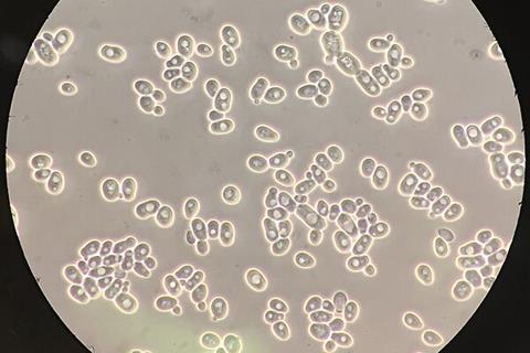 Saccharomyces_cerevisiae_100x_phase-contrast_microscopy2 (1)