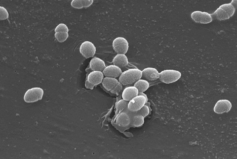 800px-Enterococcus_faecalis_SEM_01