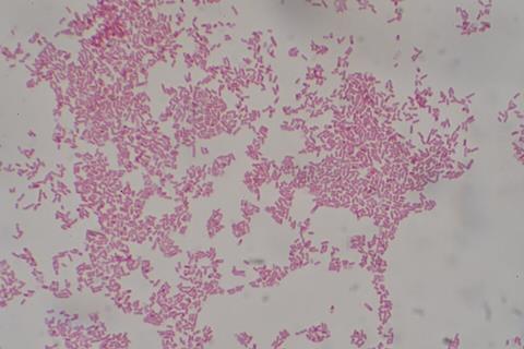 Escherichia_coli_Gram_Stain