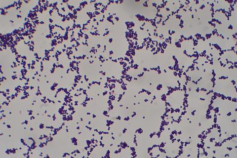 Staphylococcus_aureus_Gram_stain