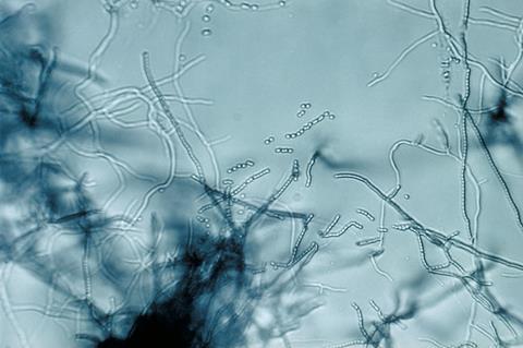 Streptomyces_sp_01 (1)