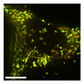 Mitochondrial_OMM_and_matrix_in_MEF_WT_CCCP