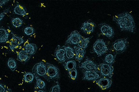 Lung_cells_infection_by_Pseudomonas_aeruginosa.tif