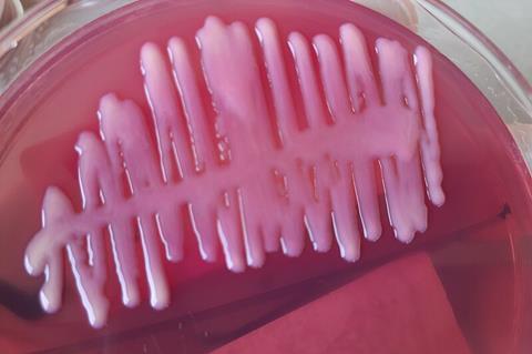 Klebsiella_pneumoniae_mucoid_colony_on_Macconkey_medium