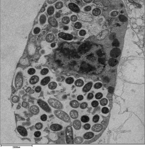 lossless-page1-583px-TEM_image_of_Legionella_pneumophila_within_a_phagocytic_cell.tif