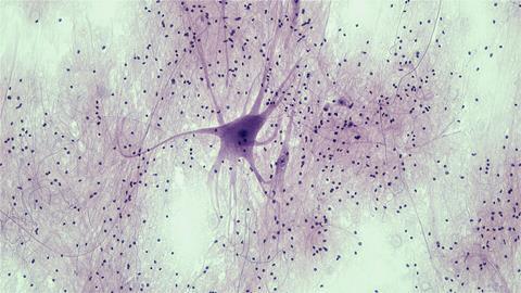 Nervous_Tissue_Spinal_Cord_Motor_Neuron_(41850849912)