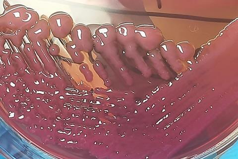 Acinetobacter_baumannii_Complex_on_MacConkey_Agar