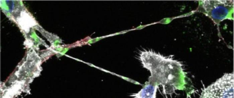 Low-Res_ebola nanotube texas biomed