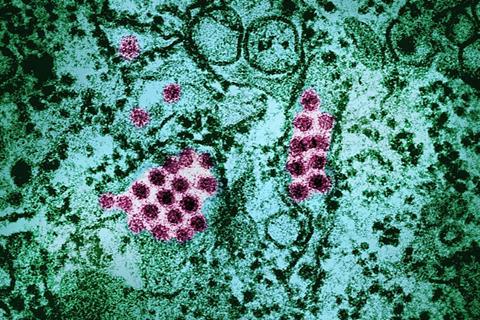 Dengue_Virus_Particles_(53232416990)