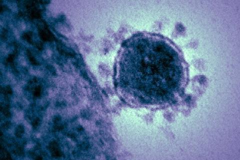Middle_East_respiratory_syndrome-related_coronavirus
