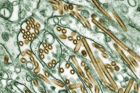 Colorized_transmission_electron_micrograph_of_Avian_influenza_A_H5N1_viruses