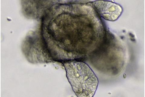 Intestinal organoid