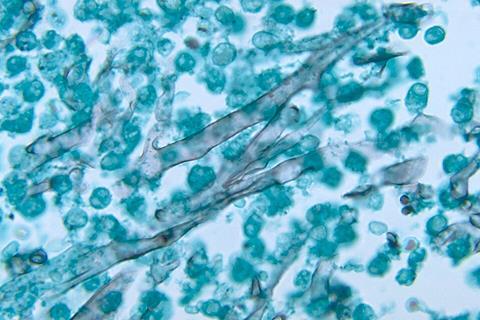 Zygomycosis_caused_by_Mucor_pusillus_PHIL_4234_lores