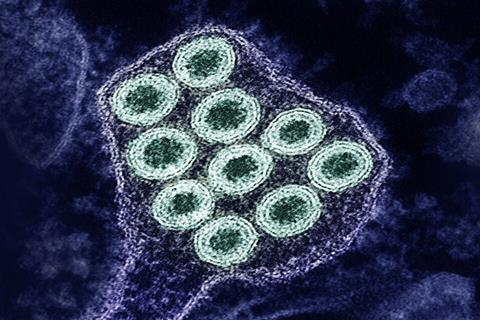 Colorized_transmission_electron_micrograph_of_rabies_virus_particles_(green)_image_captured_at_the_NIAID_Integrated_Research_Facility_in_Fort_Detrick,_Maryland_-_1