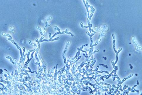 Saccharomyces cerevisiae yeast