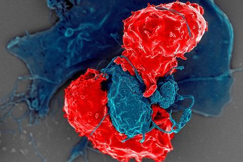 T_Regulatory_Cells_(33031032718)